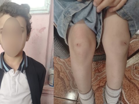 &ldquo;4-cü sinif şagirdi nəvəmi məktəbin ayaqyolunda döyüb&rdquo; - Foto