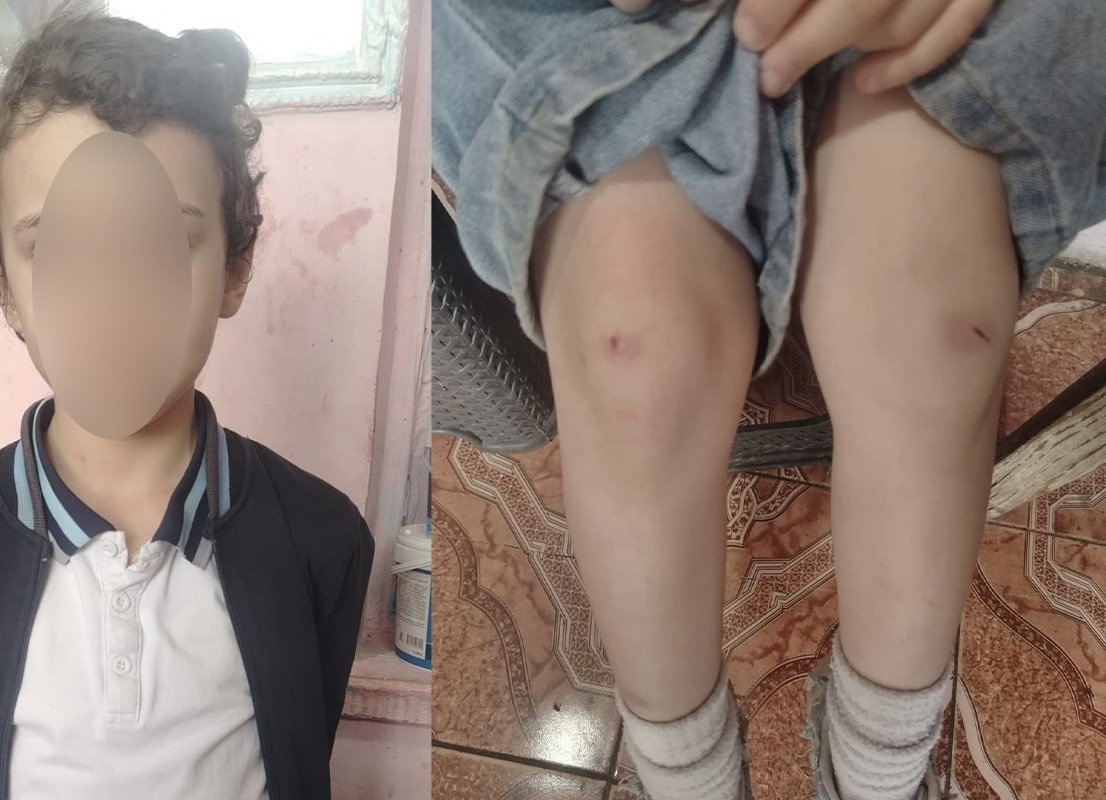 &ldquo;4-cü sinif şagirdi nəvəmi məktəbin ayaqyolunda döyüb&rdquo; - Foto